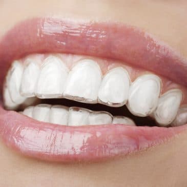 COSMETIC DENTISTRY AT MURFREESBORO